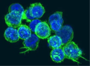 Th17cells