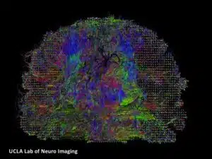 Whitematter