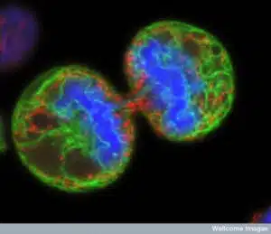 human melanoma cells