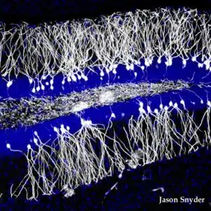 ooold neurons