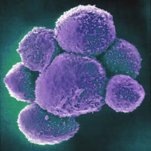 Natural Killer Cell subtypes and markers in human PBMC