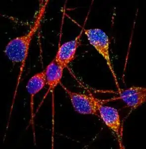 ISSCR 2013 Meeting Updates: Can Alzheimer’s Disease be modeled in a dish? 1 40004_web