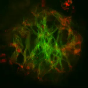 MAPK Pathway Components: Modulators of Ataxin1 Toxicity in SCA1 1 amyloid