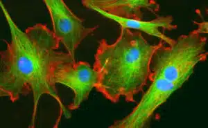 Remodeling of the Tumor Extracellular Matrix Activates YAP in Fibroblasts to Produce Cancer Associated Fibroblasts 1 fibroblast