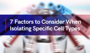 7 Factors to Consider Website