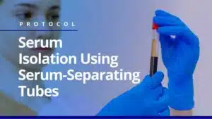 Serum Isolation
