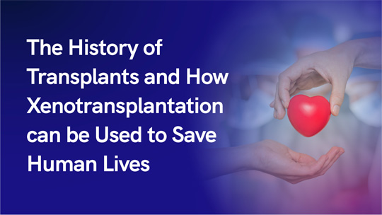 The History of Transplants and
How Xenotransplantation can
be Used to Save Human Lives