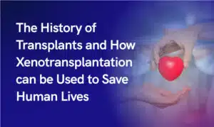 The History of Transplants Web banner Option 2