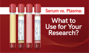 Serum vs. Plasma - Sanguine Biosciences Inc.