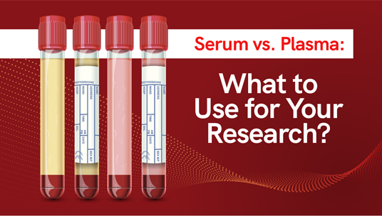Serum vs. Plasma: What to Use
for Your Research?