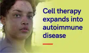 Cell therapy expands into autoimmune disease Website