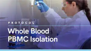 Whole Blood PBMC Isolation Option 1