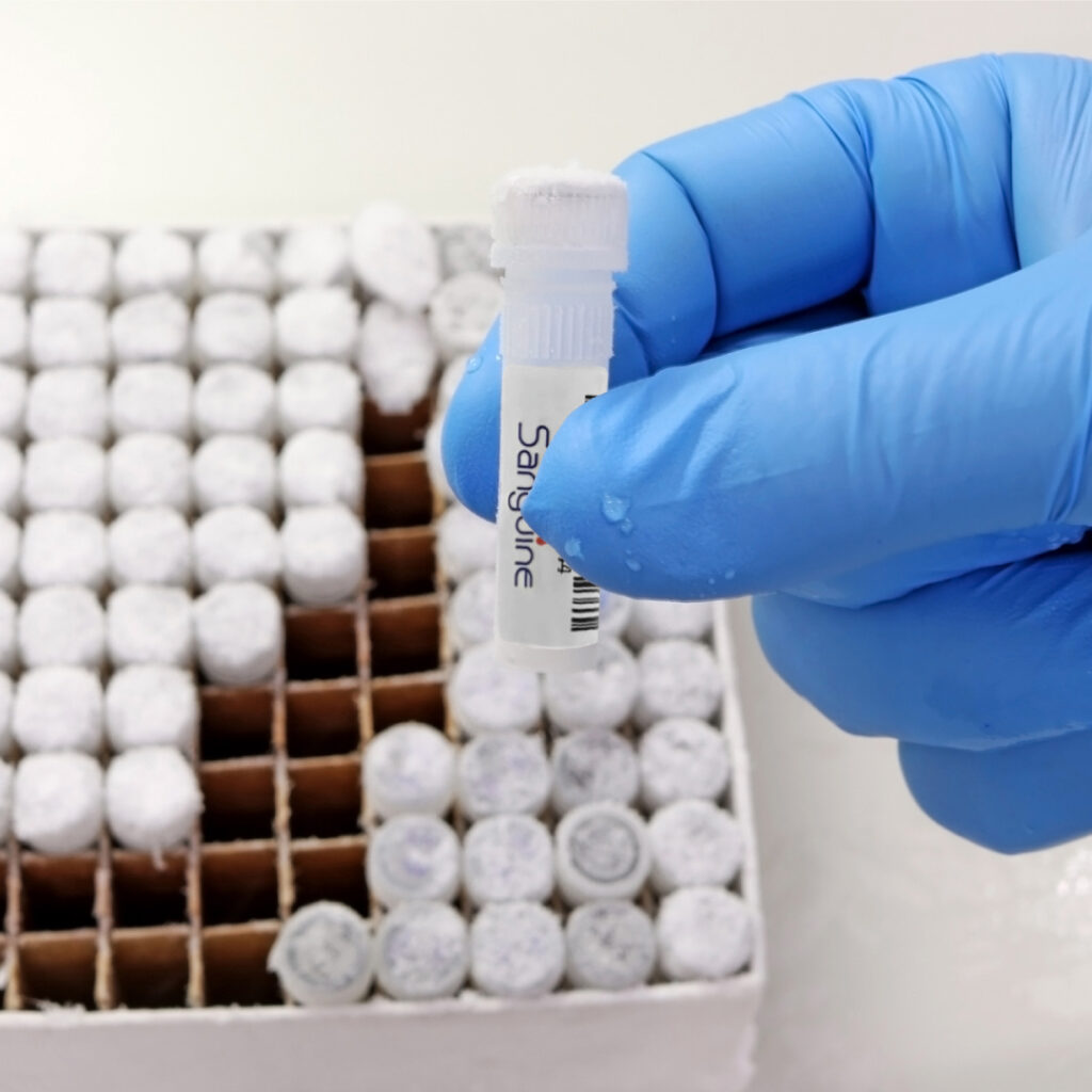 Purchasing PBMC - Peripheral Blood Mononuclear Cells - Sanguine Biosciences