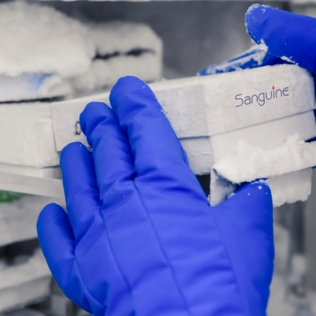 PBMC in disease research is stored in the freezer