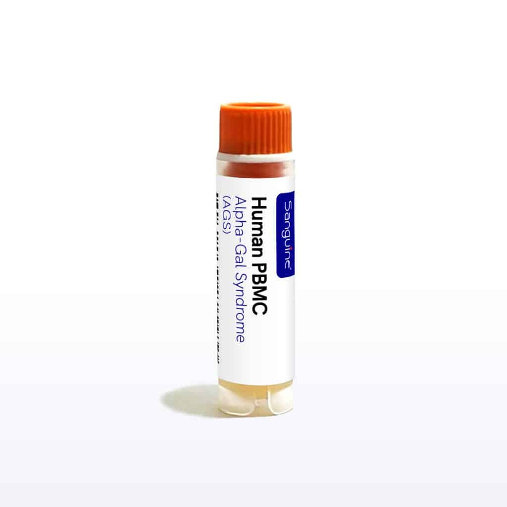 Alpha-Gal Syndrome PBMC