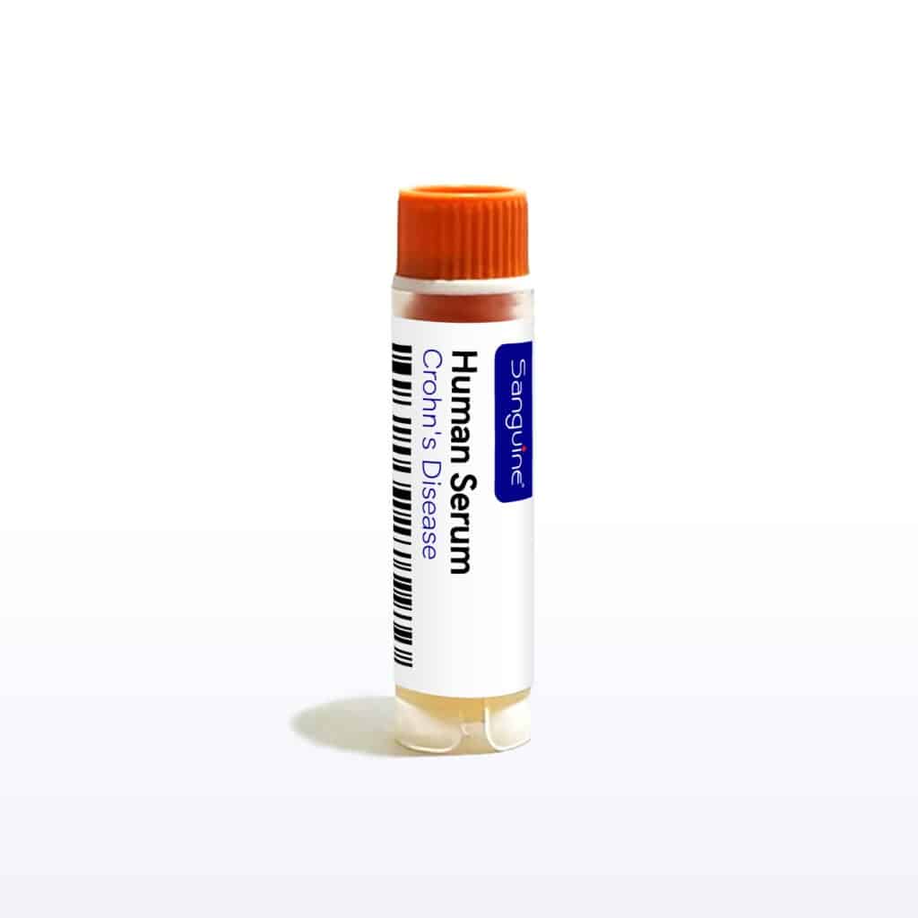Crohn’s Disease Serum