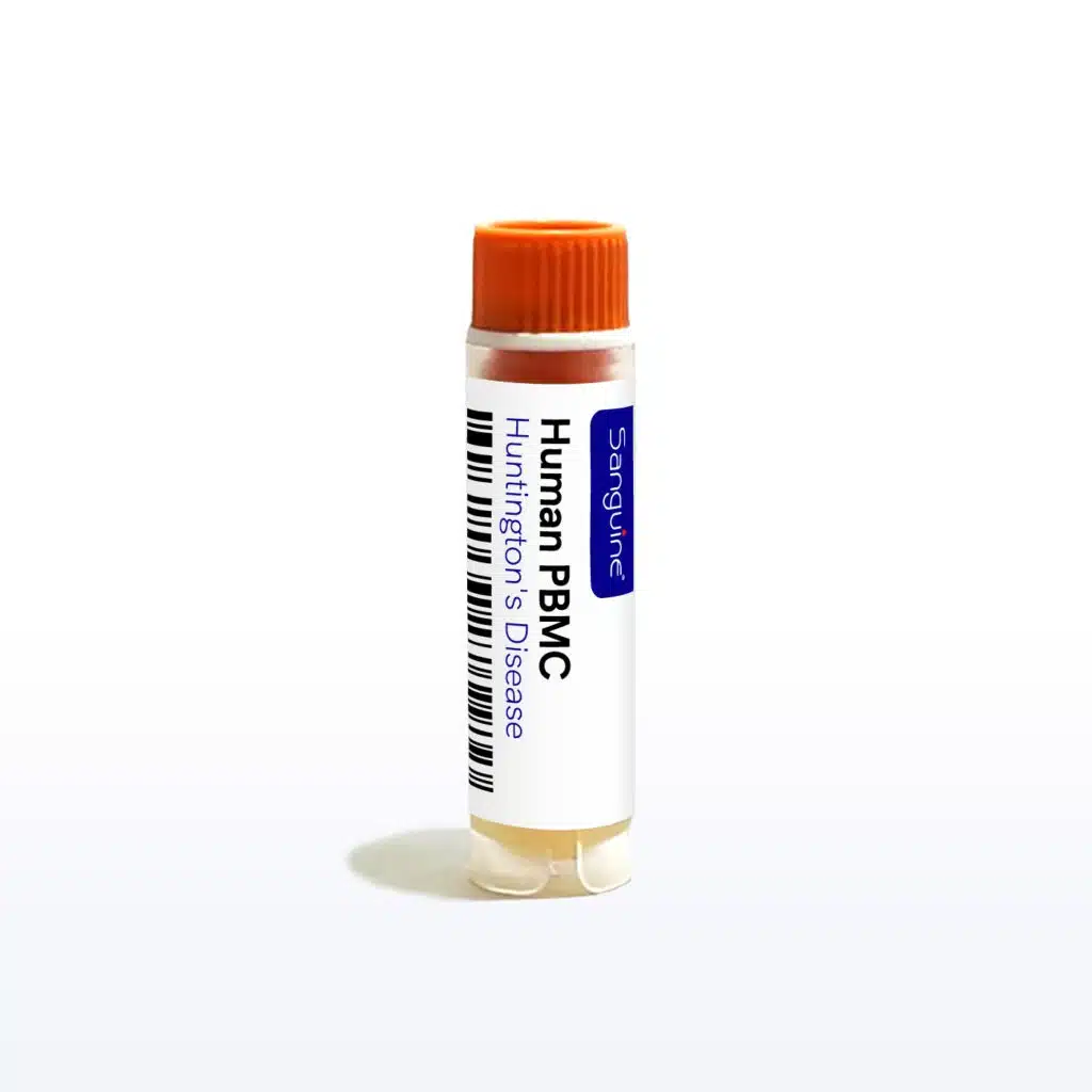 Huntington’s Disease PBMC