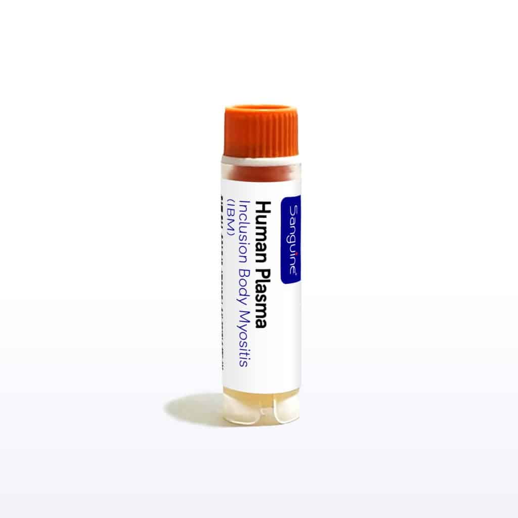 Inclusion Body Myositis Plasma