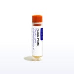 Cryovial of Discoid Lupus Erythematosus PBMC - Sanguine Biosciences, Inc.
