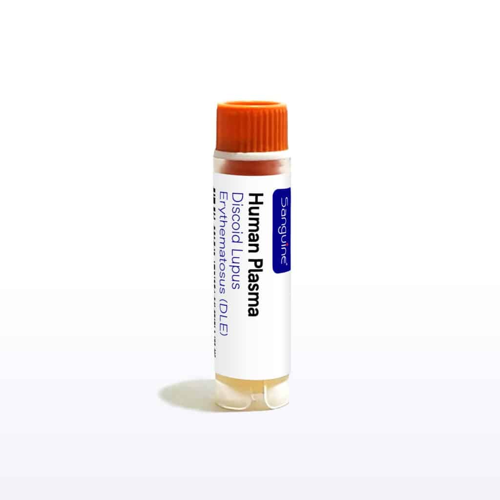 Discoid Lupus Erythematosus Plasma