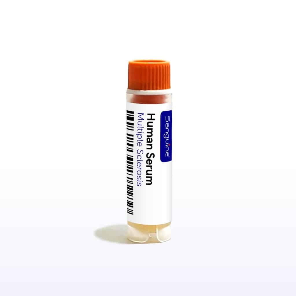 Multiple Sclerosis Serum