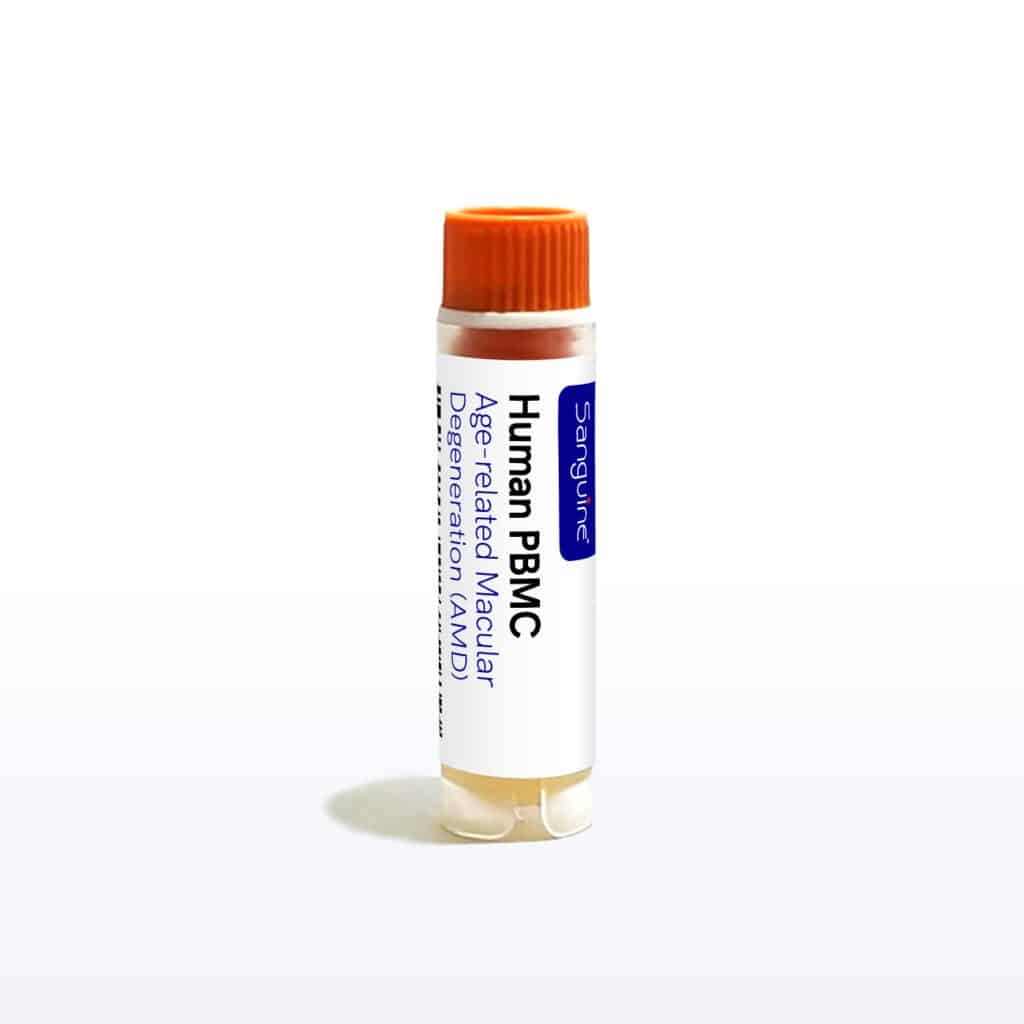 Age-related Macular Degeneration PBMC