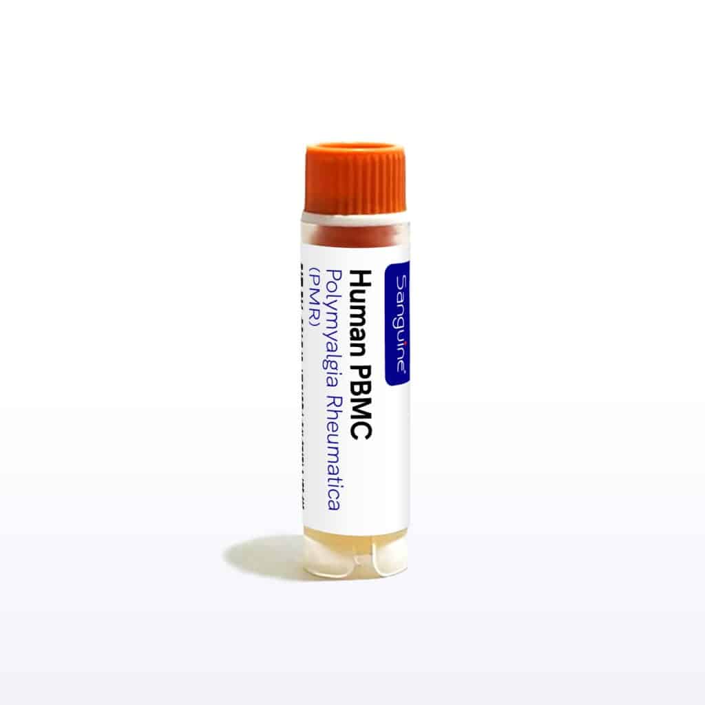 Polymyalgia Rheumatica PBMC