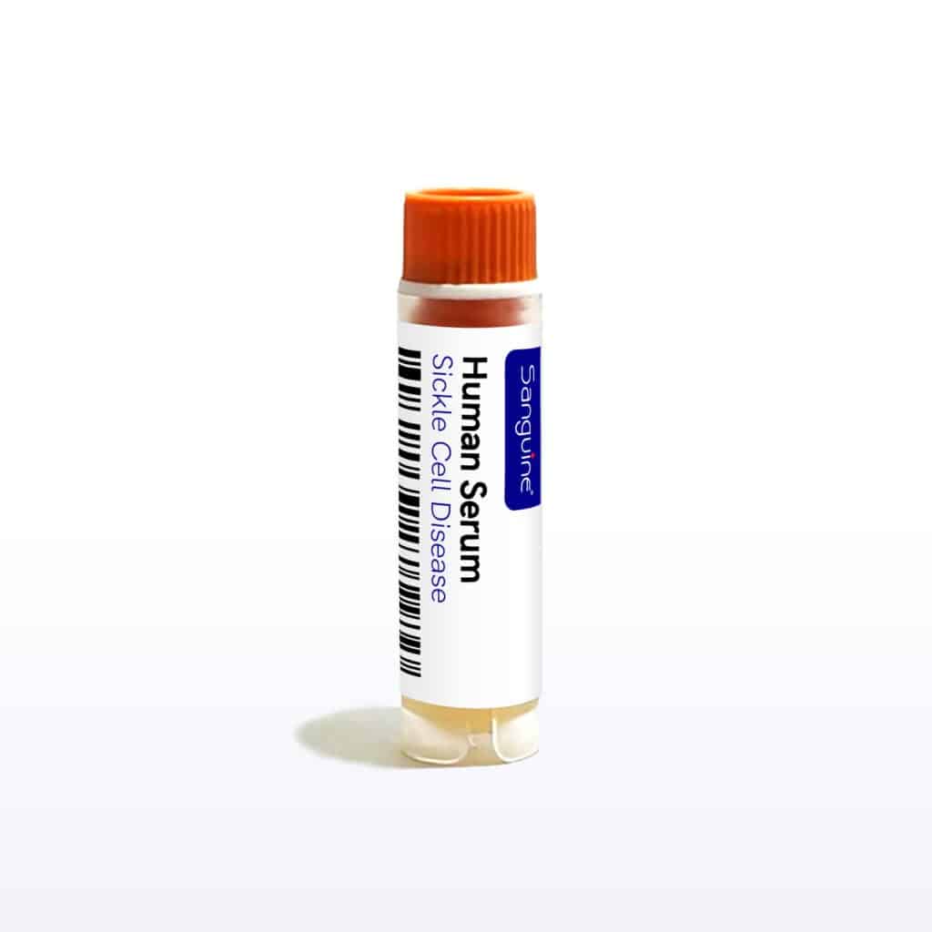 Sickle Cell Disease Serum
