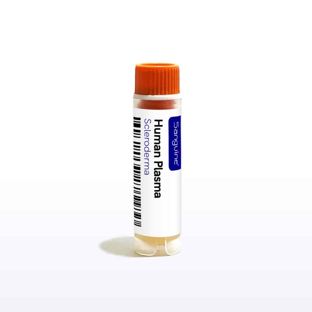 Scleroderma Plasma