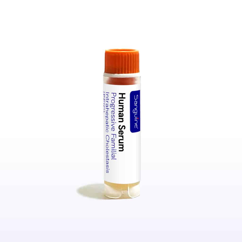 PFIC Serum
