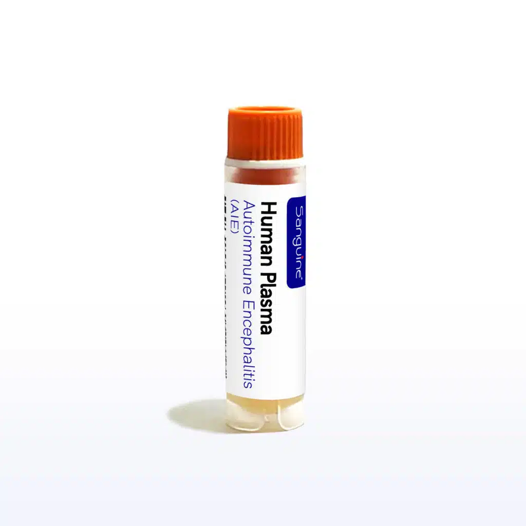 Autoimmune Encephalitis Plasma