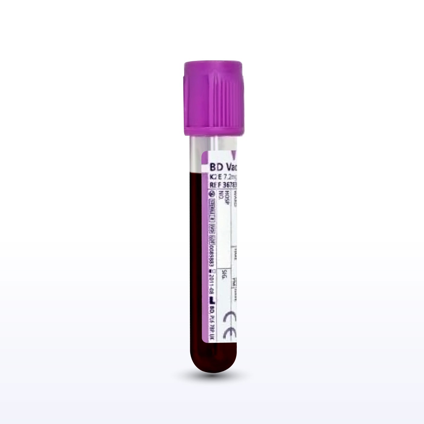 Acute Intermittent Porphyria Whole Blood