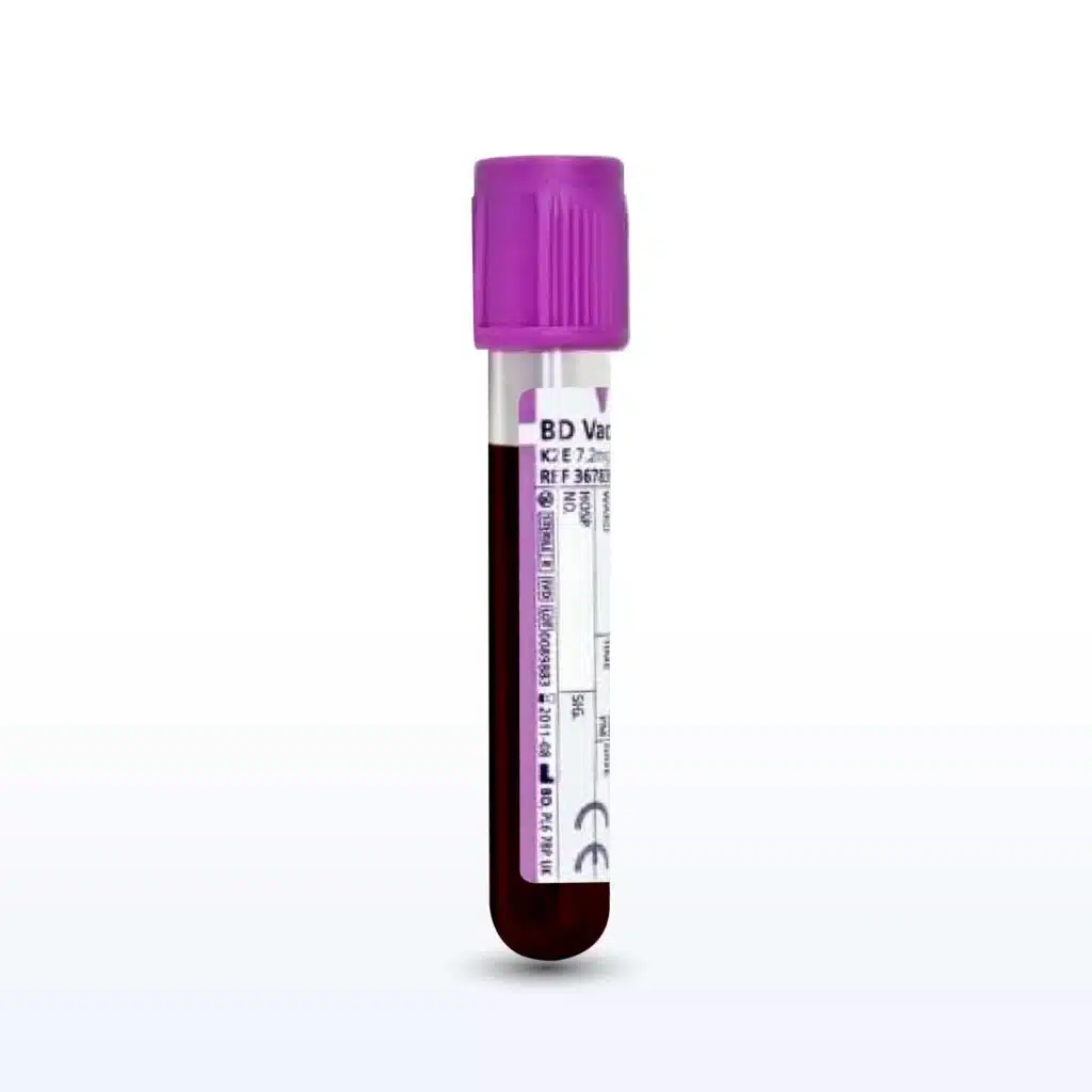 Colorectal Cancer Whole Blood