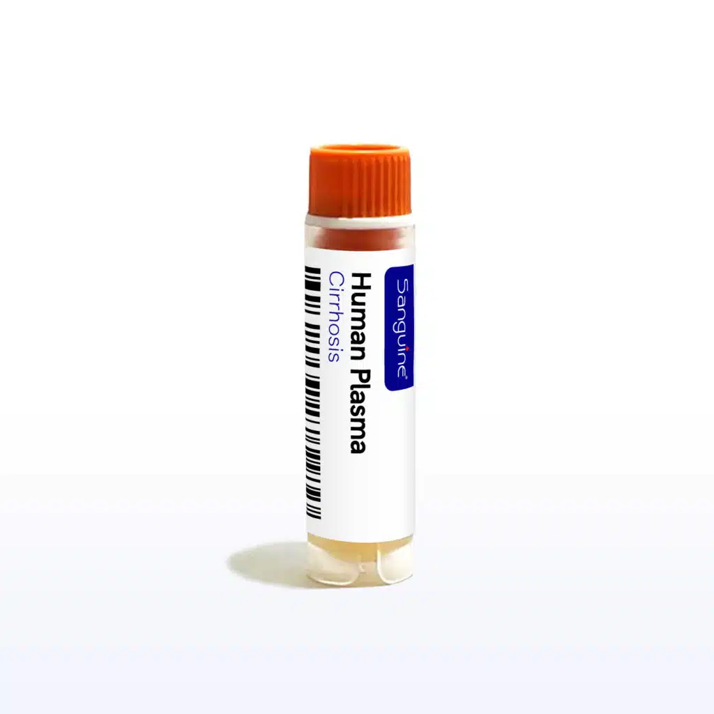 Cirrhosis Plasma