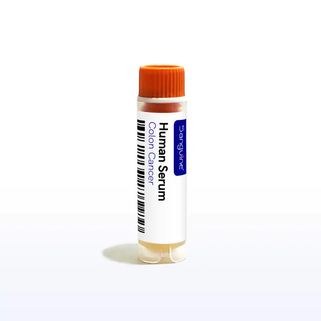 Colon Cancer Serum