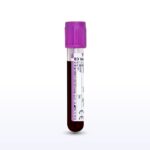 Eosinophilic Esophagitis Whole Blood - Sanguine Biosciences, Inc