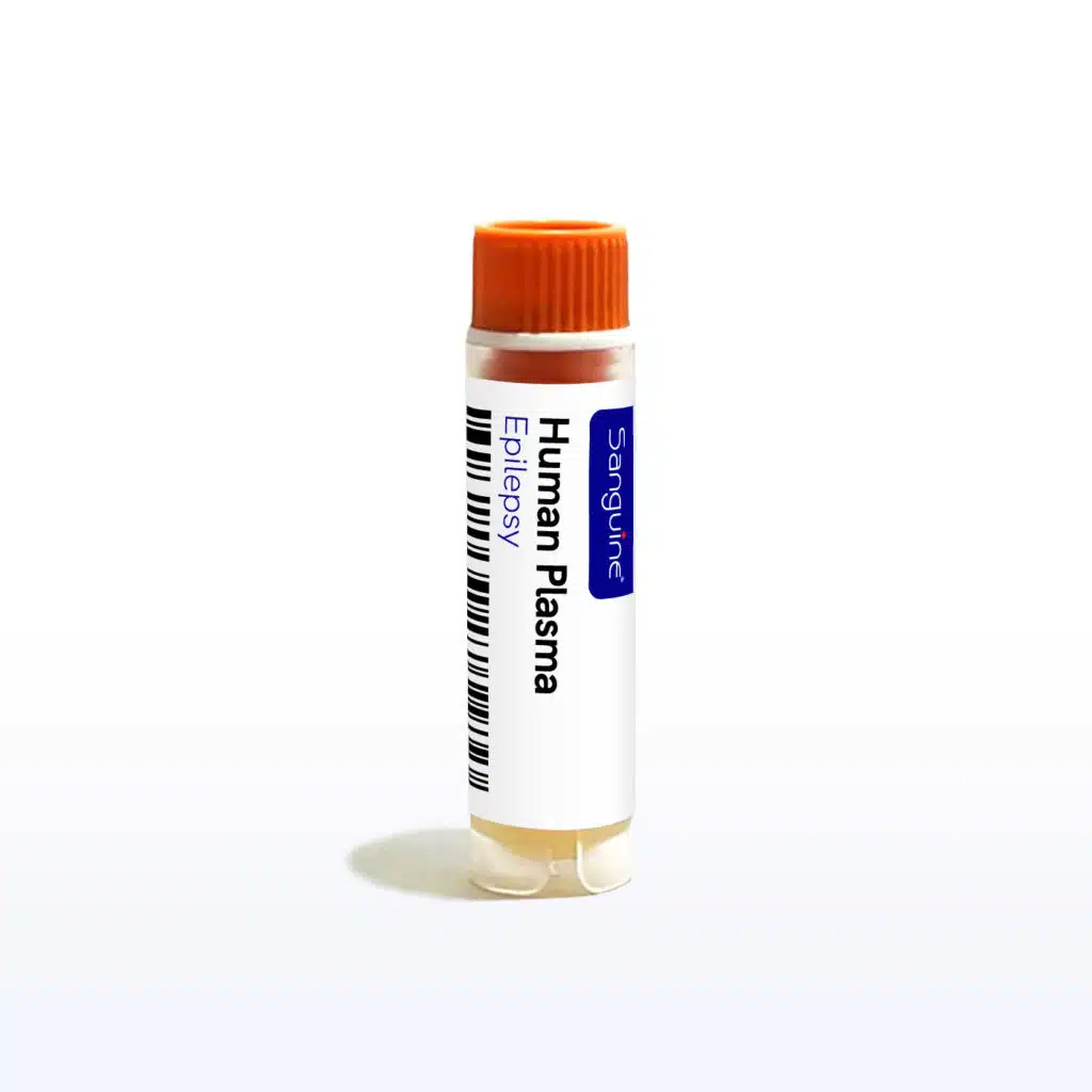 Epilepsy Plasma