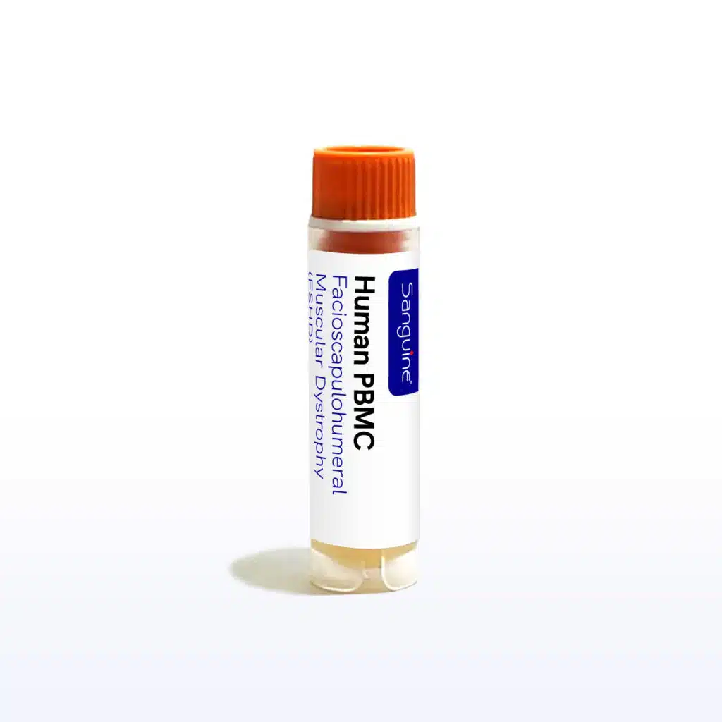 Facioscapulohumeral Muscular Dystrophy PBMC