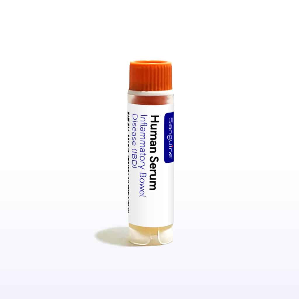 Inflammatory Bowel Disease Serum