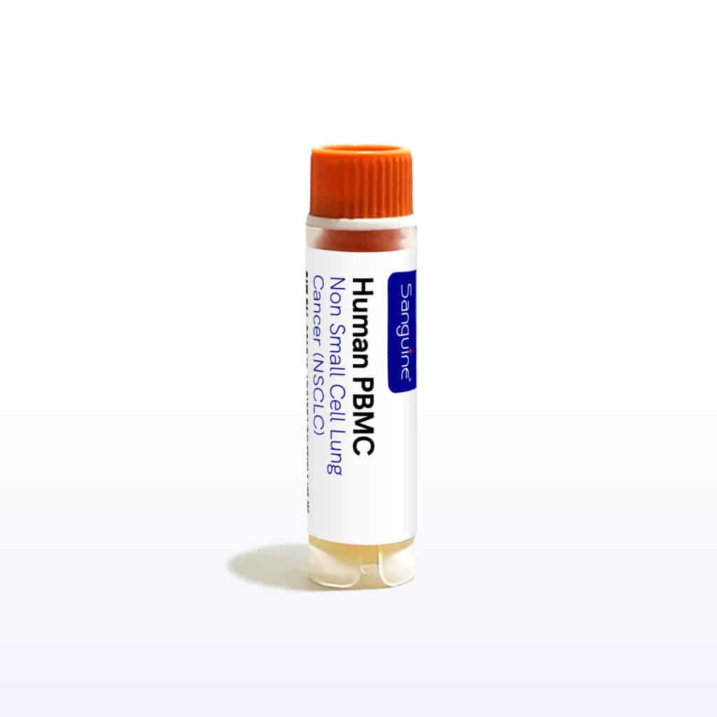 Non Small Cell Lung Cancer PBMC