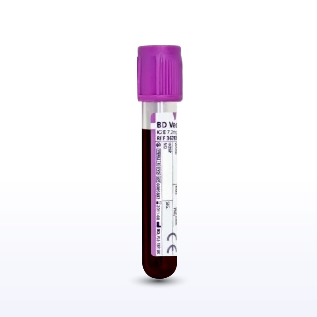 Pulmonary Fibrosis Whole Blood