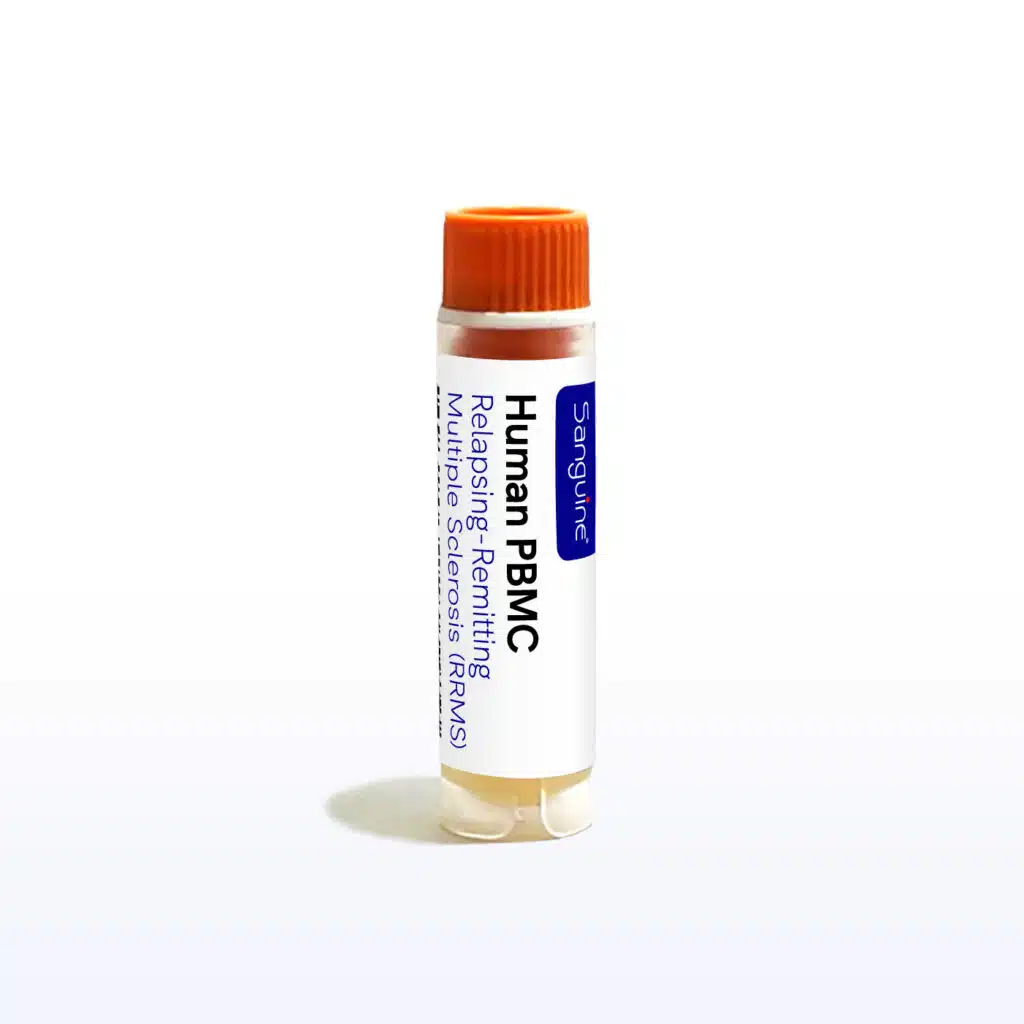 Relapsing-Remitting Multiple Sclerosis PBMC