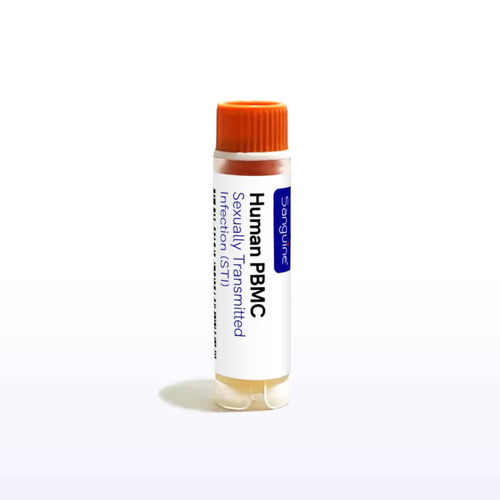 Sexually Transmitted Infection PBMC