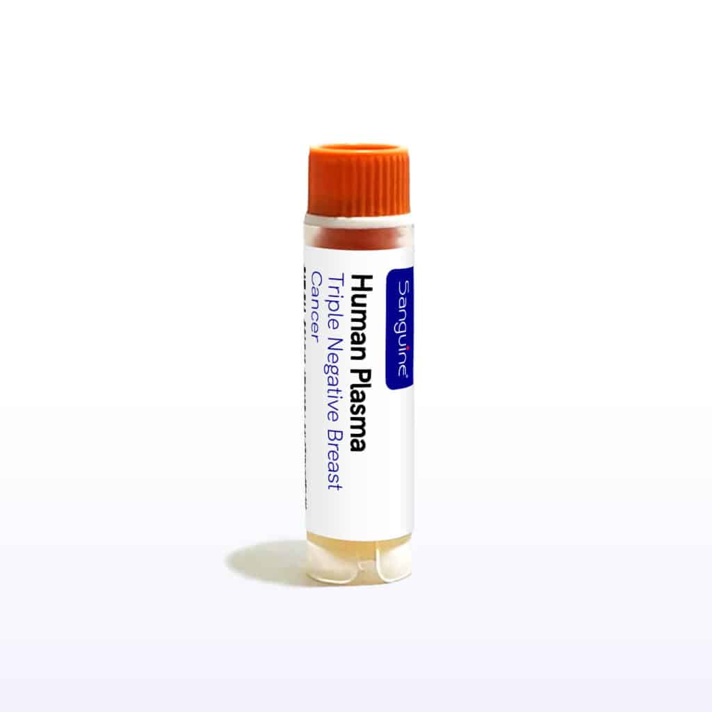 Triple Negative Breast Cancer Plasma