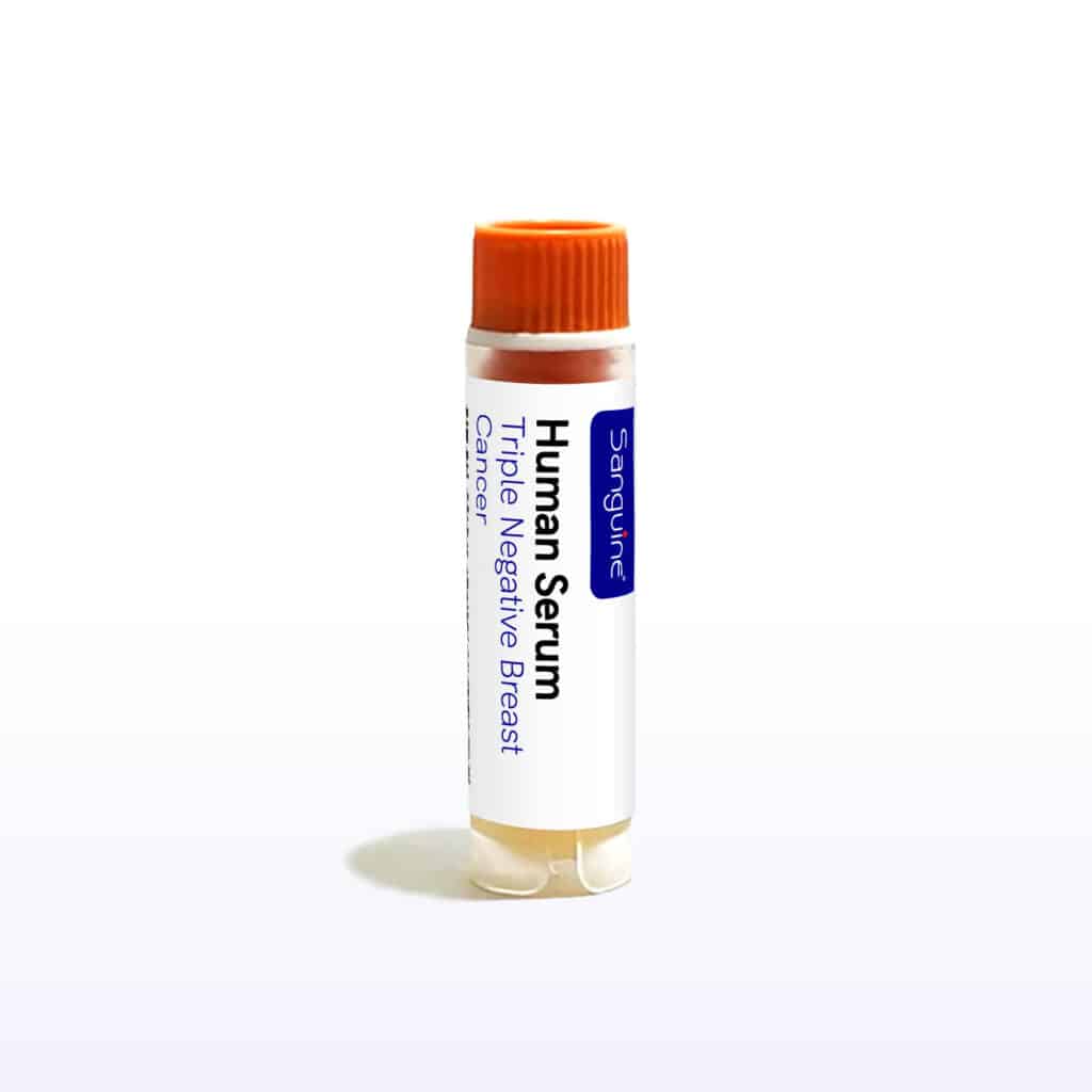 Triple Negative Breast Cancer Serum