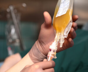 Research Using Leukopak for CAR-T therapy - Sanguine Biosciences