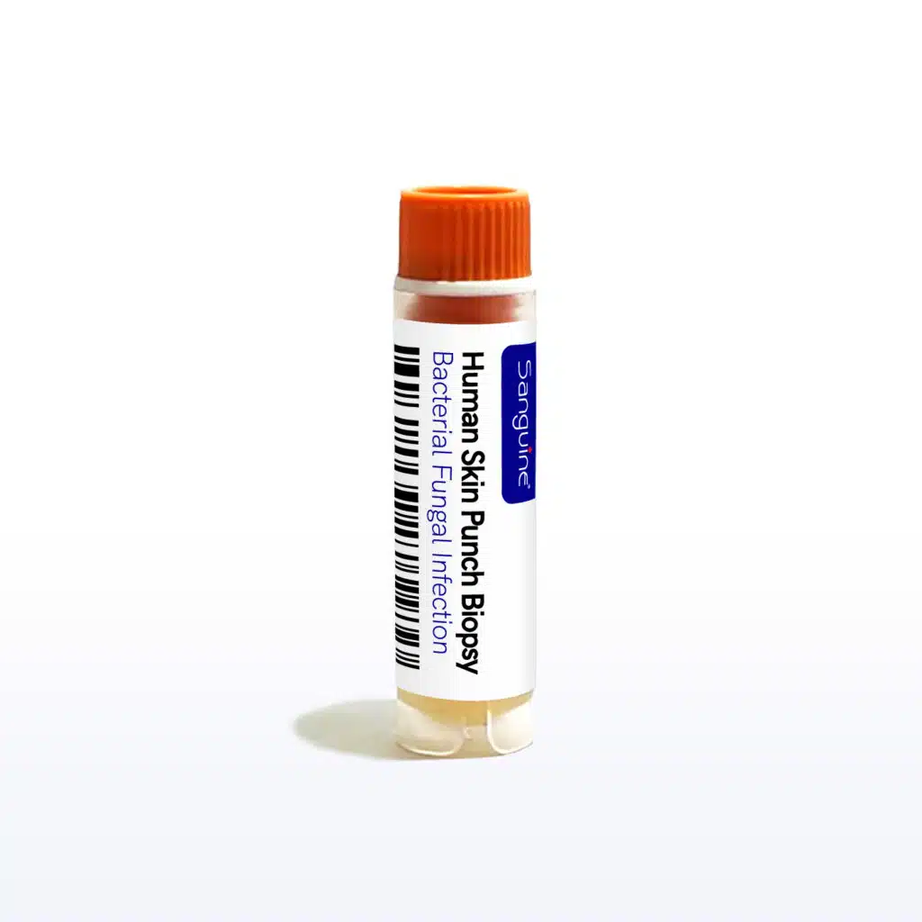 Bacterial/Fungal Infection Skin Punch Biopsy