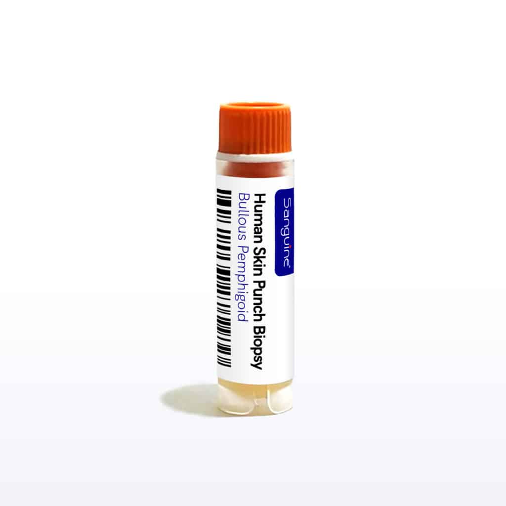 Bullous Pemphigoid Skin Punch Biopsy