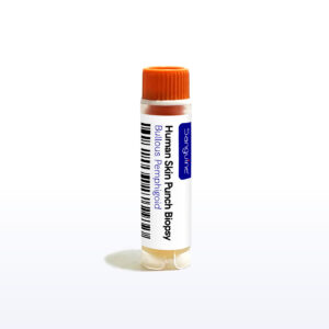 Bullous Pemphigoid Skin Punch Biopsy - Sanguine Biosciences