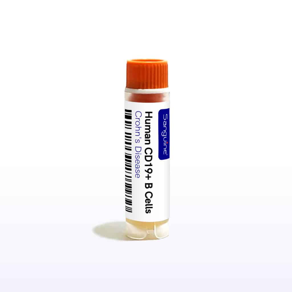 Crohn’s Disease CD19+ B Cells
